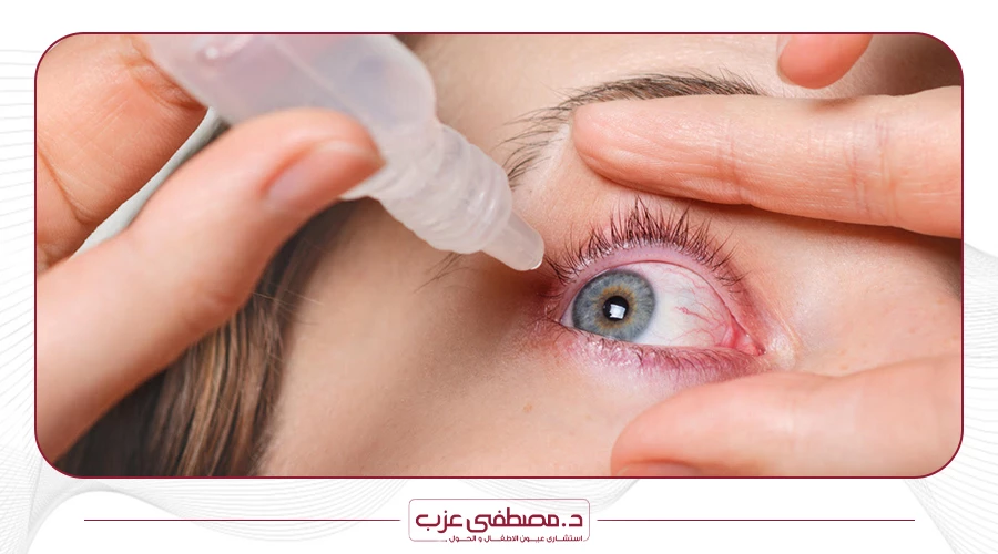 مدة علاج جفاف العين