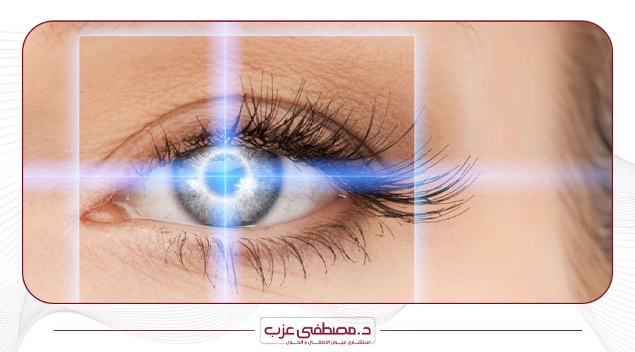 علاج حول العين بالليزر